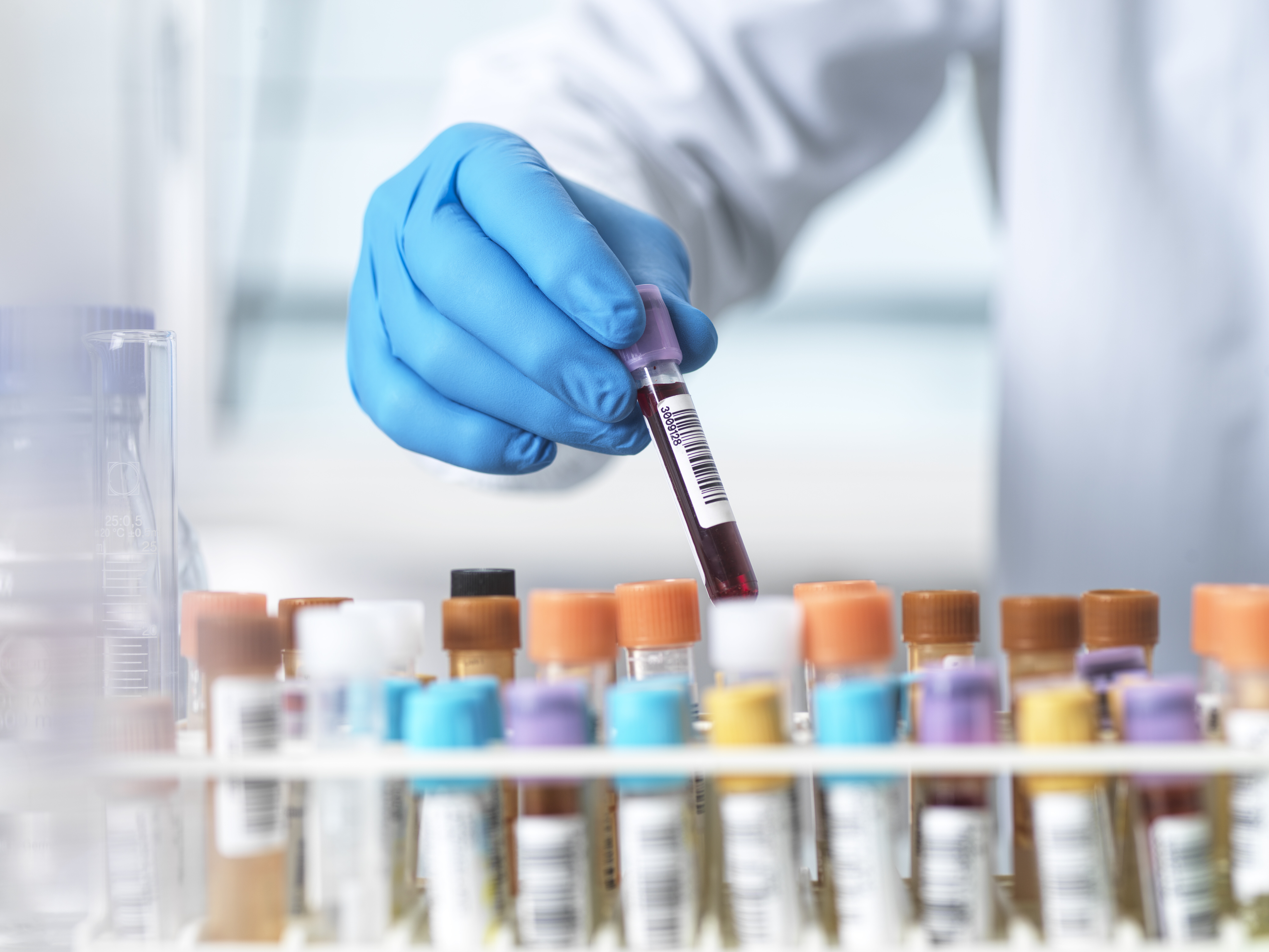 Pertactin-Positive Pertussis Strains: Antigen Composition and Clinical Relevance